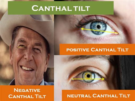 canthal tilt|how to fix canthal tilt.